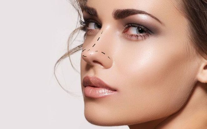 Rinomodelación con Ácido Hialurónico