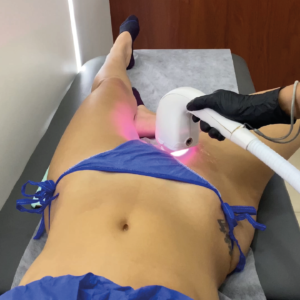 Depilación Láser Diodo en Área Mediana | Naturalness Medellín | Medicina Estética