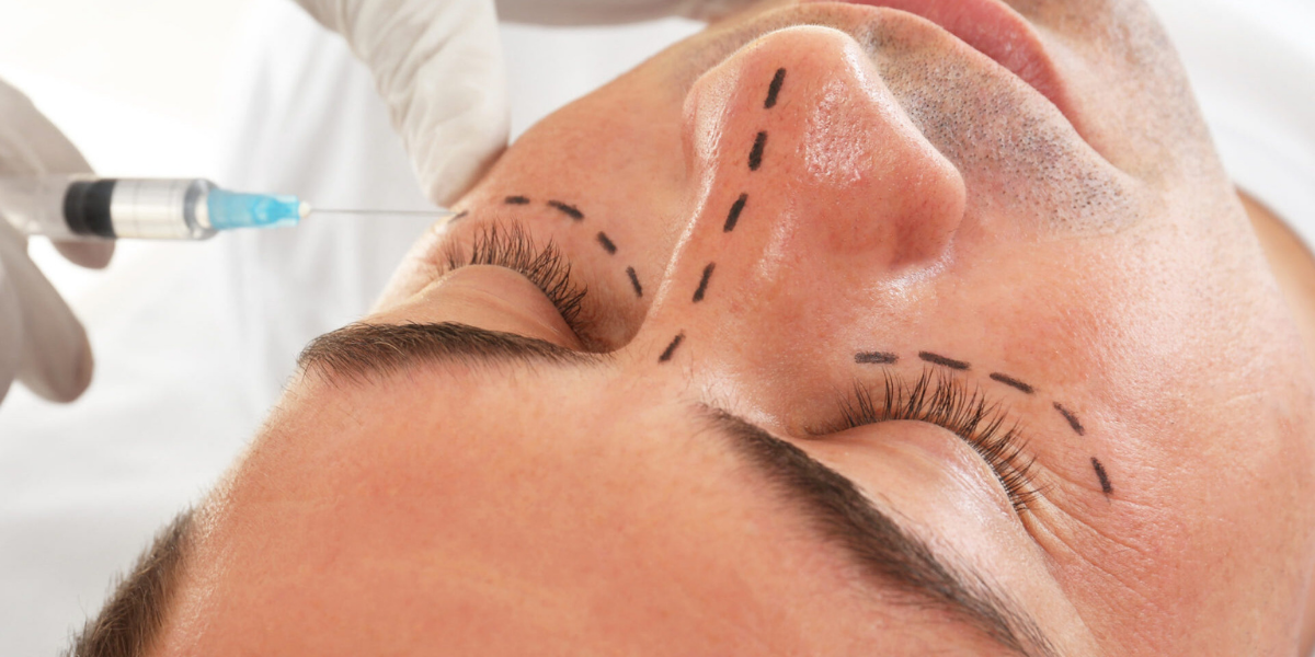 Ojeras. Blog ¿Notas que tus ojeras ahora son más pronunciadas?