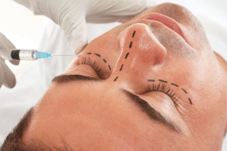 Ojeras. Blog ¿Notas que tus ojeras ahora son más pronunciadas?