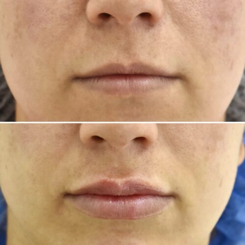 ¿Te gustaría mejorar el volumen y la hidratación de tus labios?