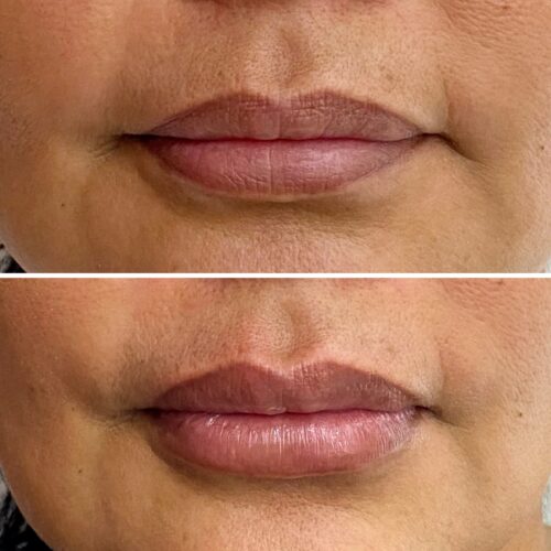 ¿Te gustaría mejorar el volumen y la hidratación de tus labios?