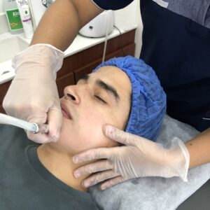Porcelanización Facial (2 sesiones)