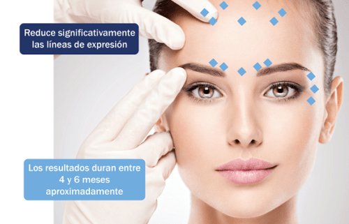 Toxina Botulínica: Mitos y realidades