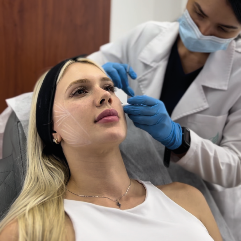 Radiesse | Naturalness Medellín | Medicina Estética Radiesse | Naturalness Medellín | Medicina Estética