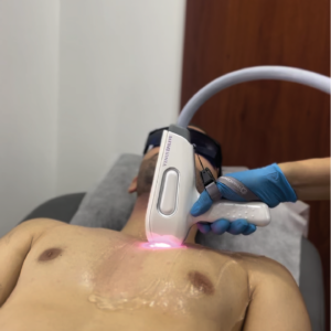 Depilación Láser Diodo en Área Grande | Naturalness Medellín | Medicina Estética