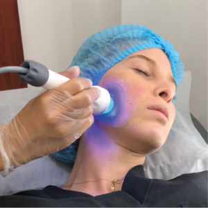 Natural Lifting | Naturalness Medellín | Medicina Estética