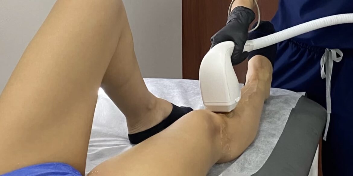 Diode laser hair removal | Naturalness Diode laser hair removal | Naturalness