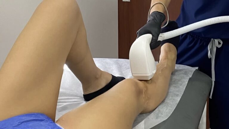 Diode laser hair removal | Naturalness