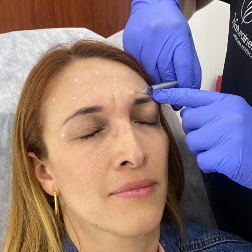 Toxina Botulínica | Naturalness