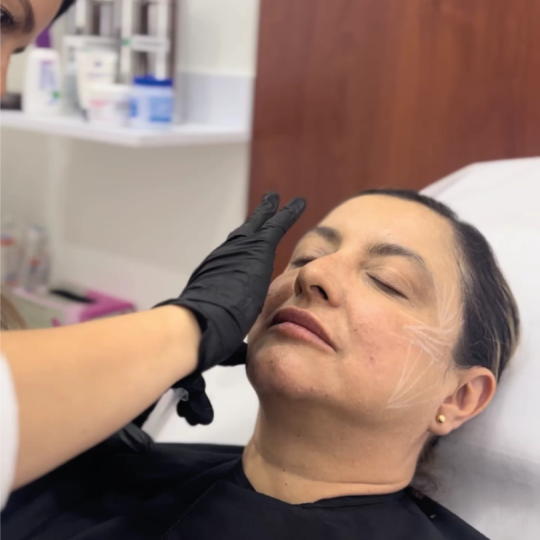 Sculptra | Naturalness Medellín | Medicina Estética